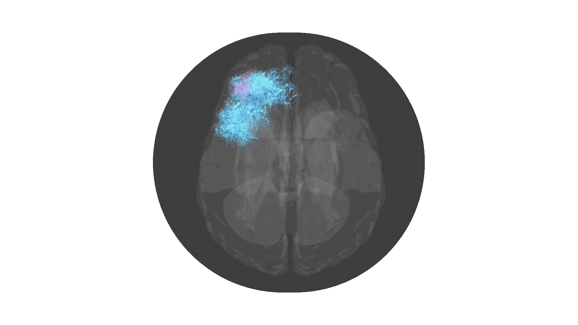 Brainscan Animation using Brainstorm