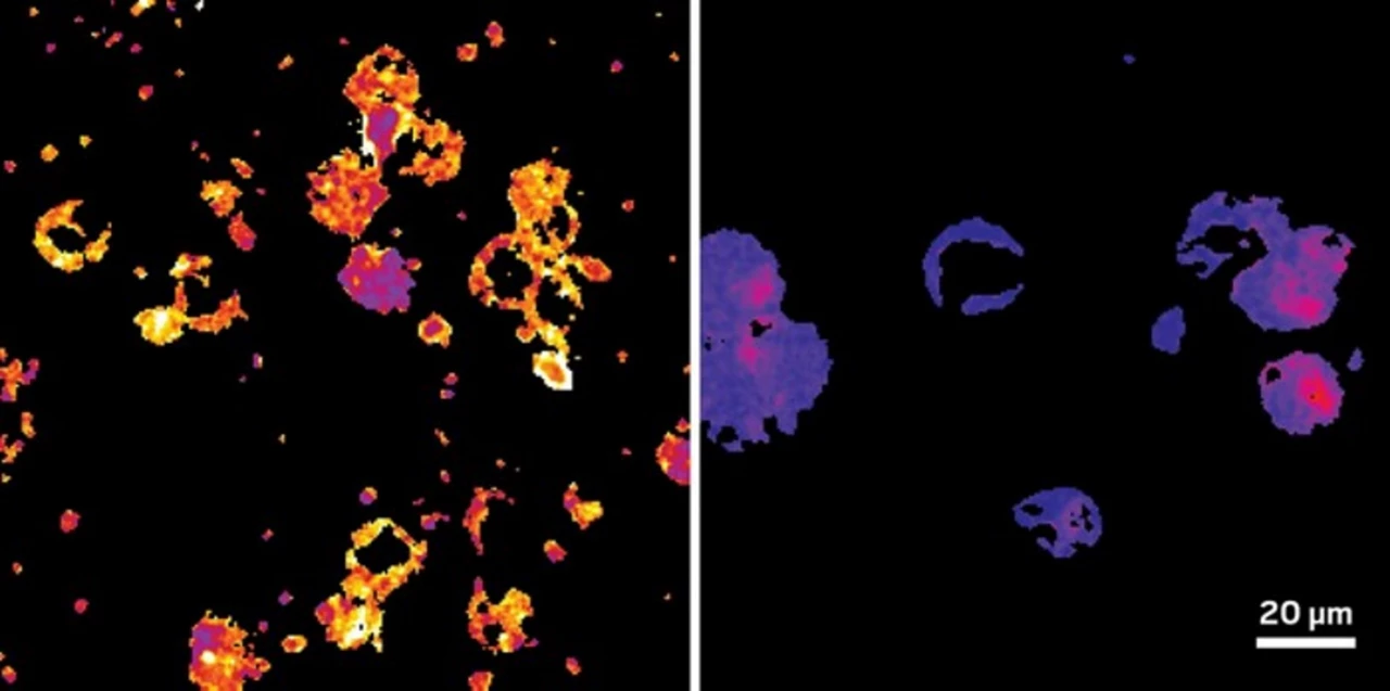 Two micrograph tiles. Left is blobs of warm colors, right is blobs of cool colors.