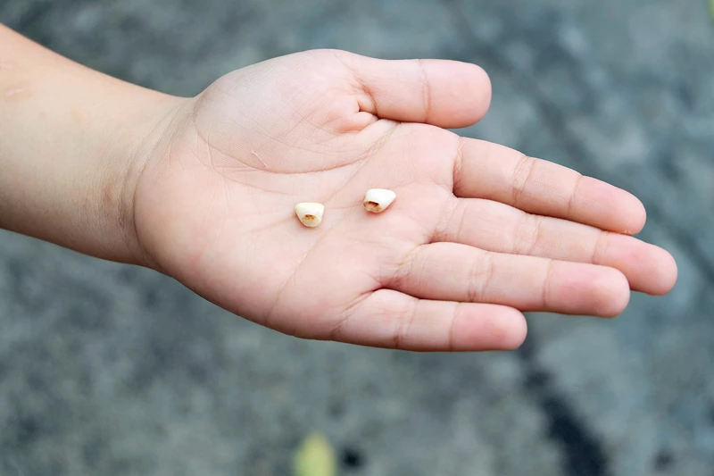 Photo of a child’s hand holding two baby teeth.