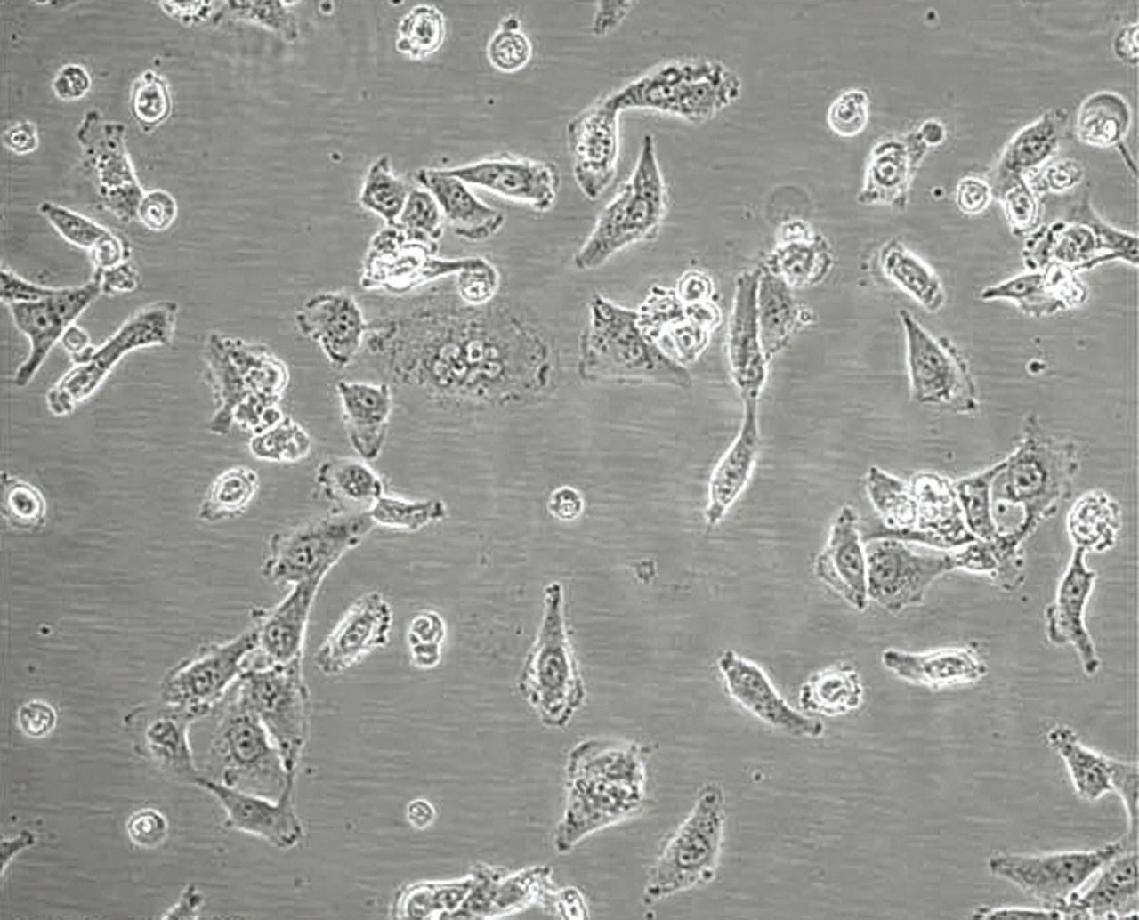 Micrograph of mislabeled cells.