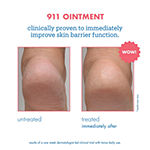 Skinfix Remedy+ 911 Ointment