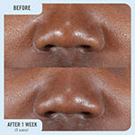 First Aid Beauty FAB Pharma Calamine Pore Purging Mask