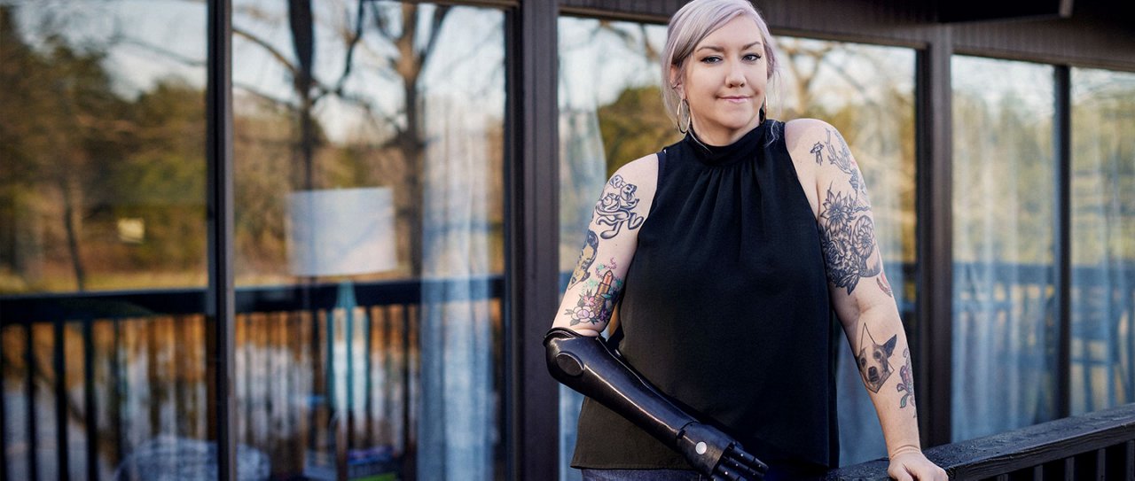 Kate's 3D printed bionic arm improved her health - and her