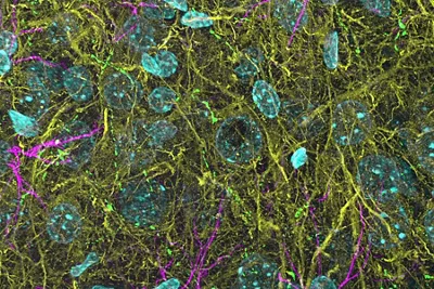 3D THUNDERed Spinning Disk Image Of Mouse Brain Kid21754304