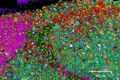Cell Phenotype Distribution With 3D 15 Plex Imaging In Murine Lymph Node Kid21756187