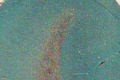 H E StainedTissue LASX Kid21764864