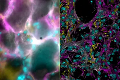 Mouse Lung Tissue Stained For A Study Of Type I Alveolar Epithelial Cell AT1 Biology Kid21768021