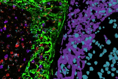 Multiplexed Human Tonsil Tissue Labeled With A Panel Of 8 OPAL Dyes And DAPI Kid21768072