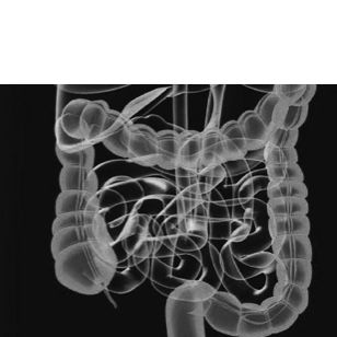 02-oncololgy-solutions-colorectal-cancer