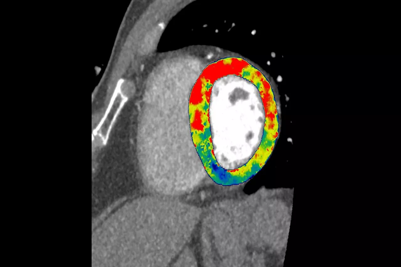 03-dynamic-ct-ci-en