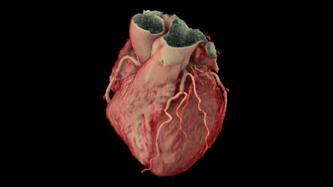 03-Imaging-RelatedContent-Webinar-CCTA-prognostic