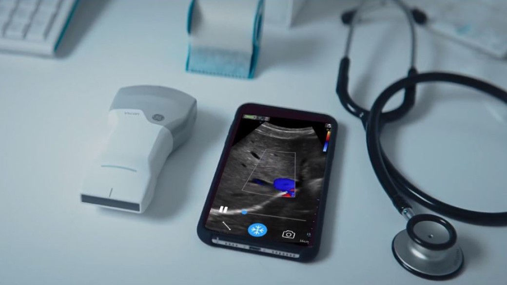 Why Clinicians Welcome GE Healthcare’s Newest Pocket-Sized Ultrasound With Open Hands