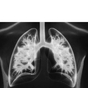 04-oncololgy-solutions-lung-cancer