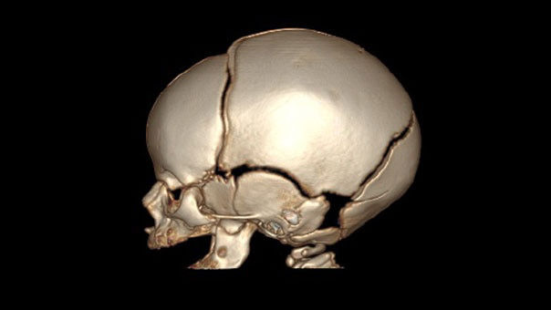 04upgrades-and-optionsfeaturecard-desktop-ci-en