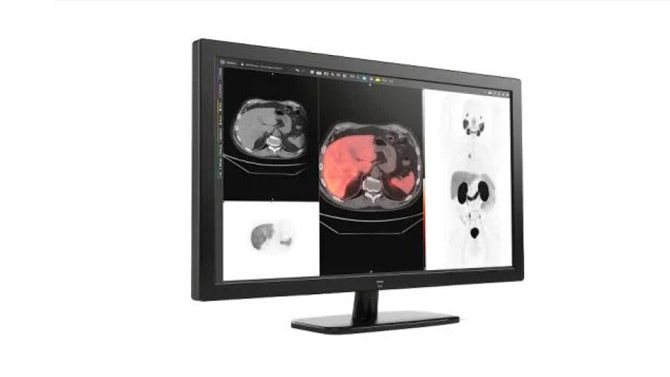 05-Imaging-RelatedContent-Resolution-recovery-and-image-enhancing
