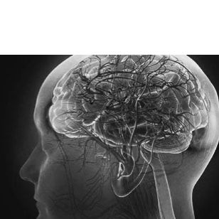 05-oncololgy-solutions-neurological-cancer