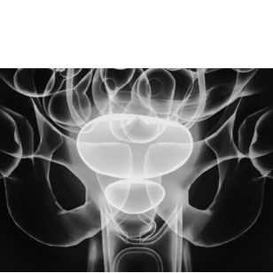 06-oncololgy-solutions-prostate-cancer