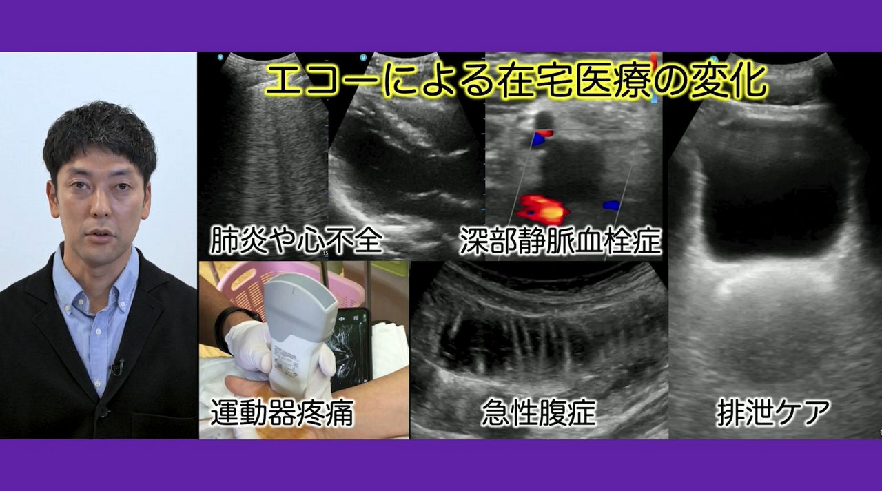 06POCUS Wazaari Dr Tada Thumbnail image