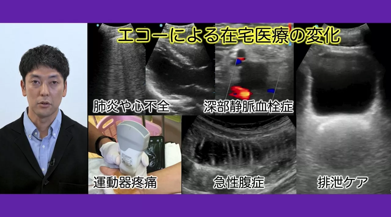 06POCUS Wazaari Dr Tada Thumbnail image