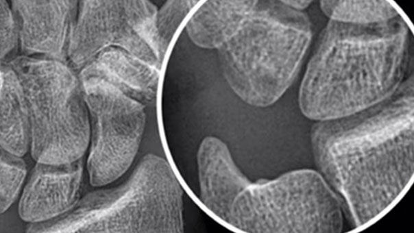 06upgrades-and-optionsfeaturecard-desktop-ci-en