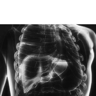 07-oncololgy-solutions-liver-cancer