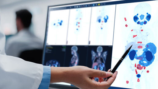 08-OmniFeatureCard616x290