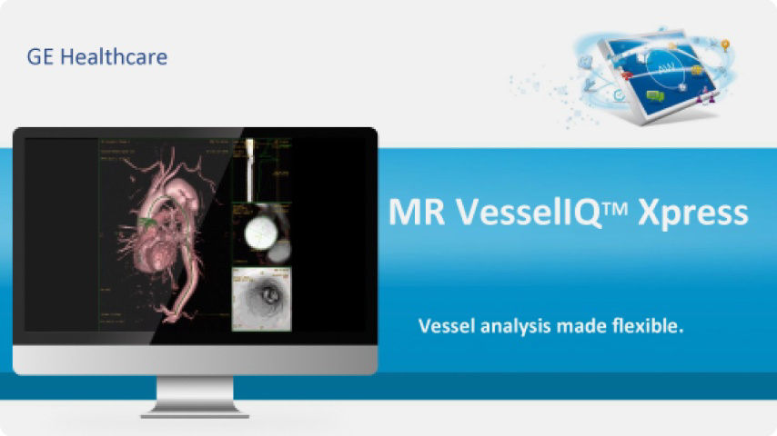 1-mr-vessel-iq-xpress-mobile