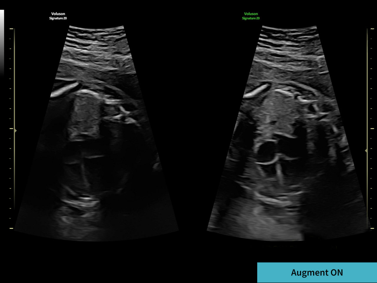 1-shadow-reduction-clinical-image