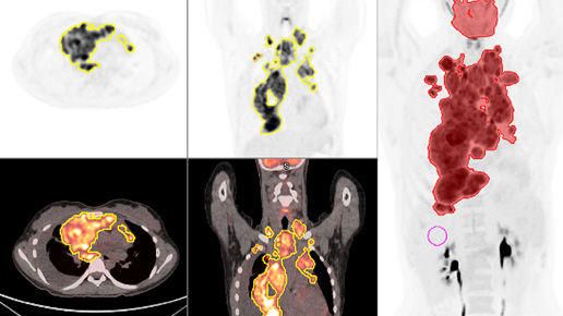 10-OmniFeatureCard616x290
