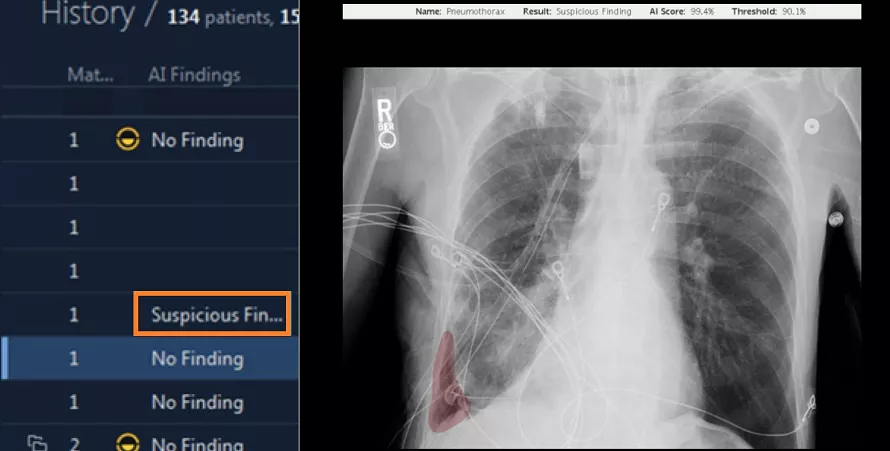 10-SuspiciousFindingptx890x450