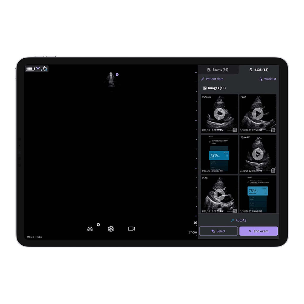 Vscan Air™ SL Innovations  