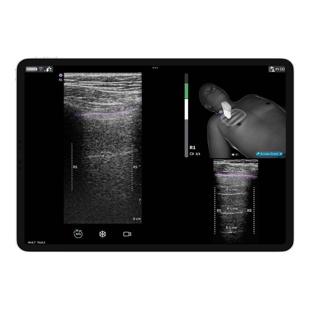 Vscan Air™ SL Innovations  