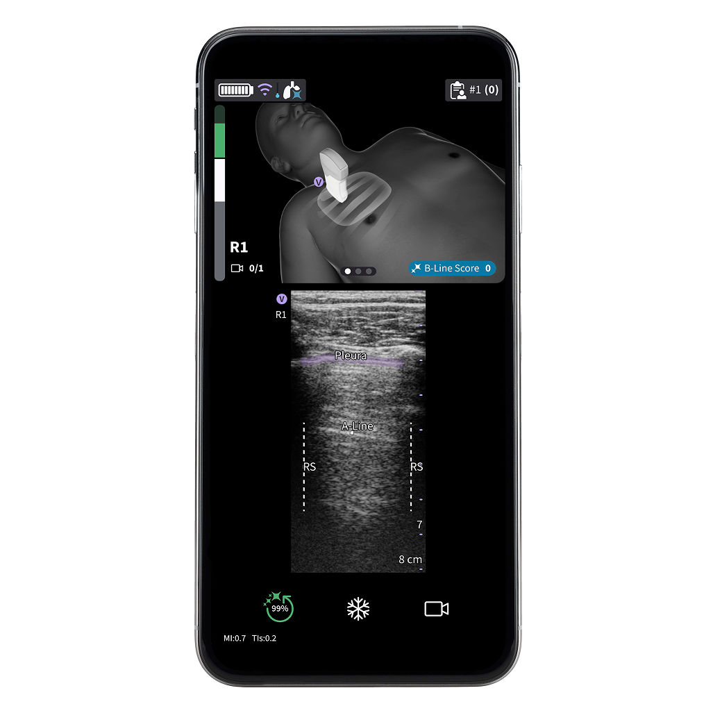 Vscan Air™ SL Innovations  