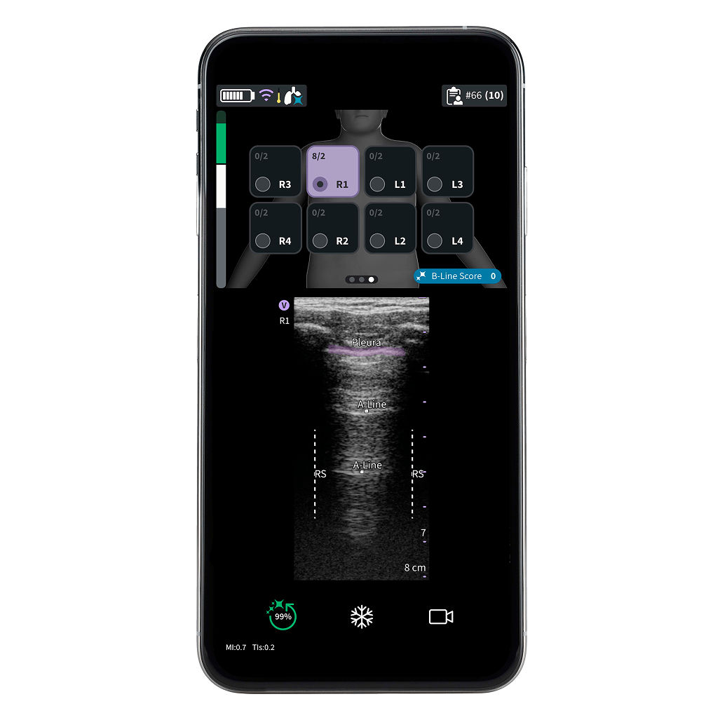 Vscan Air™ SL Innovations  