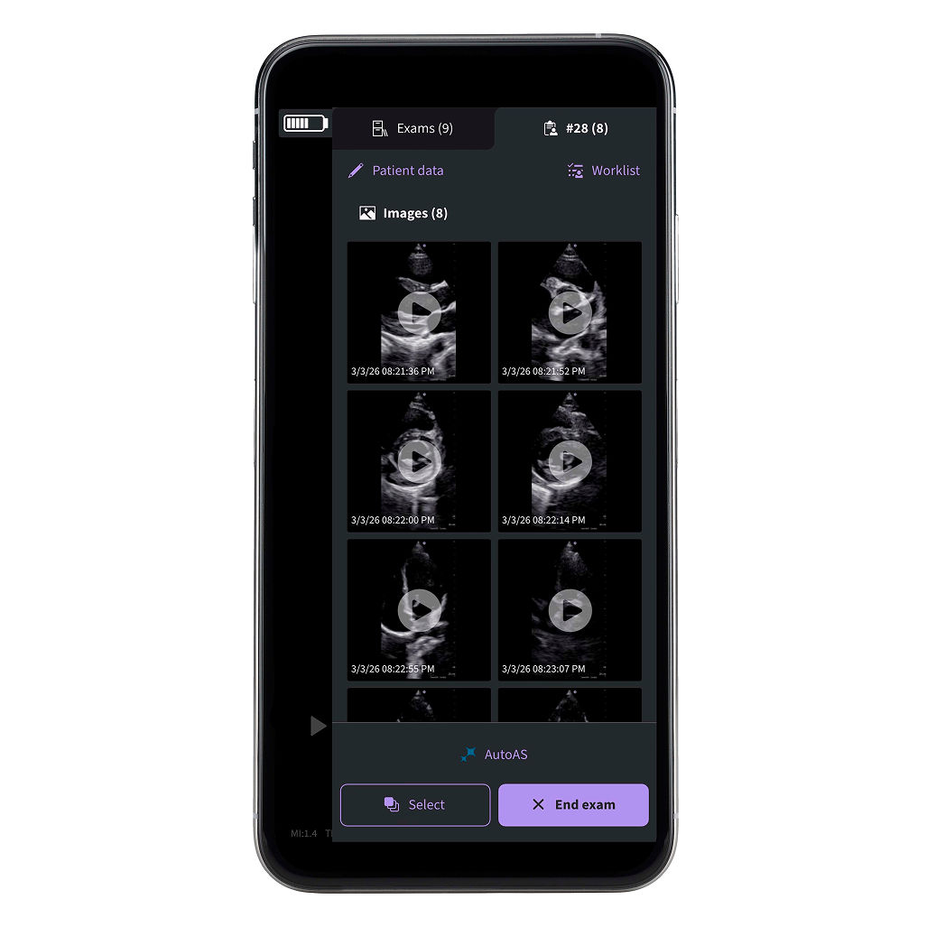 Vscan Air™ SL