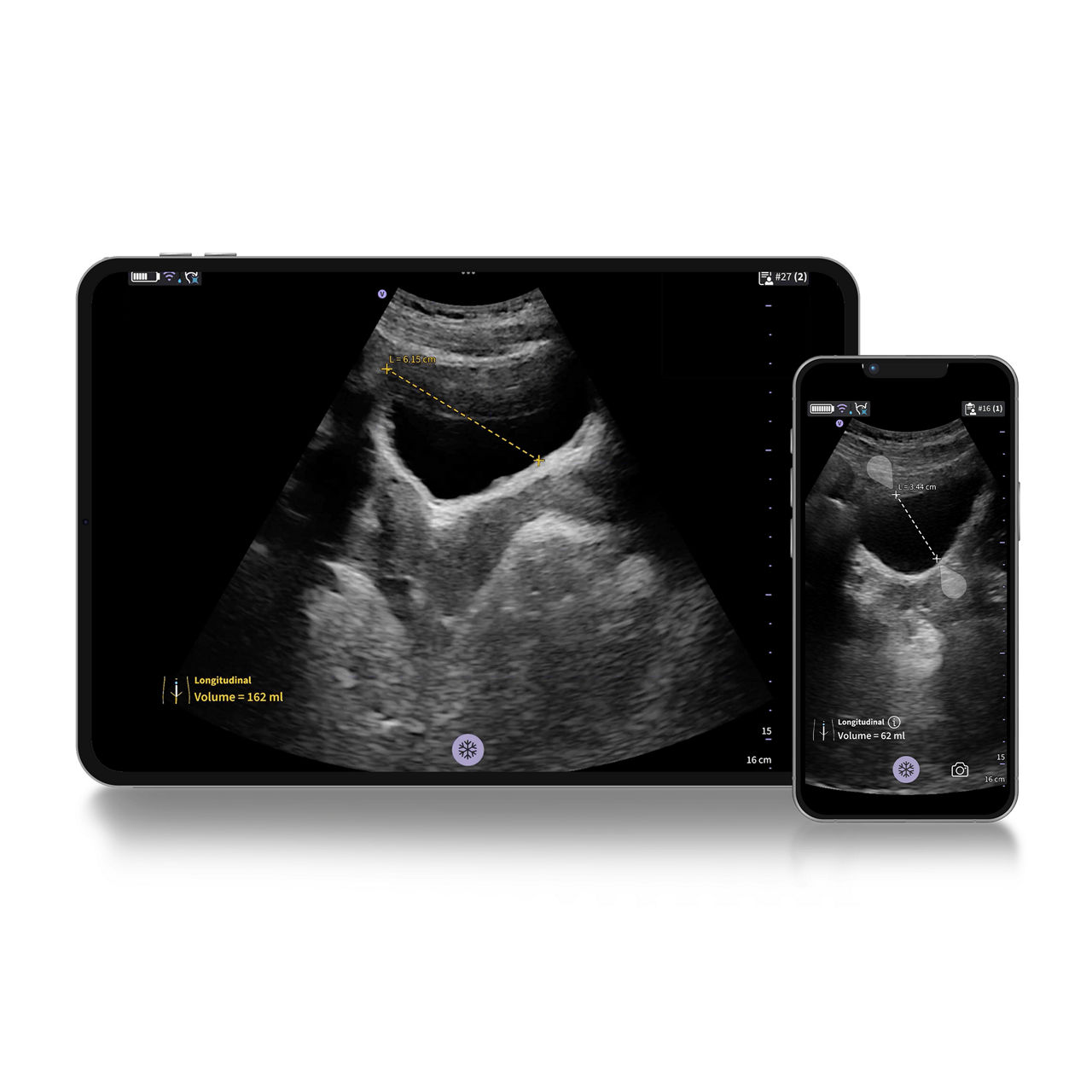 Vscan Air™ CL Innovations 
