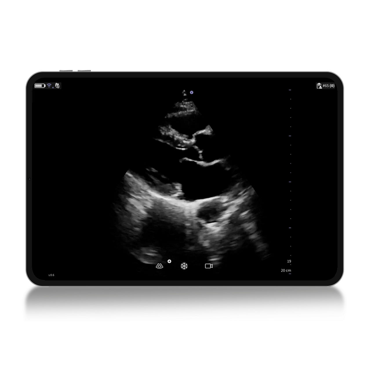 Vscan Air™ SL Innovations  