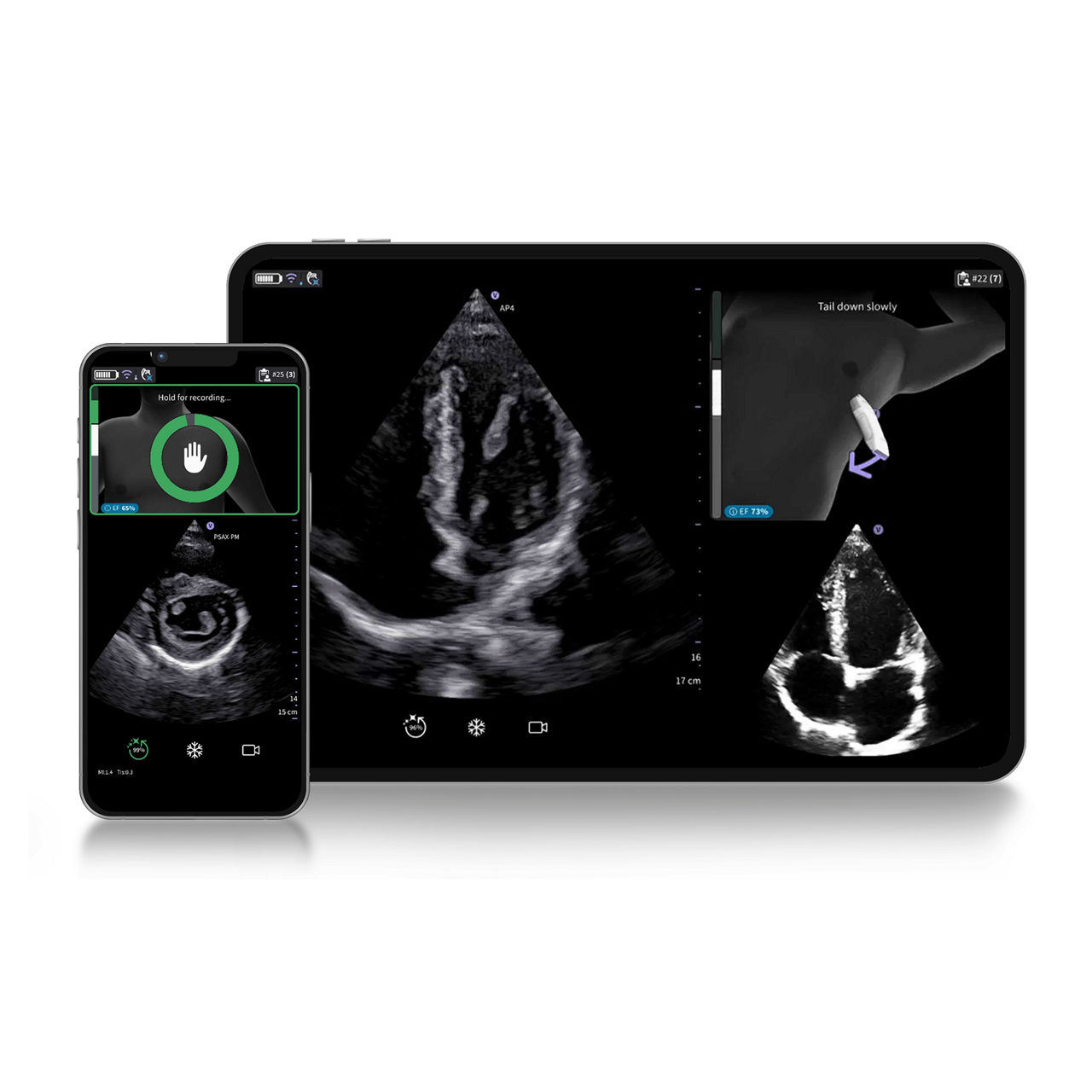 Vscan Air™ SL Innovations  