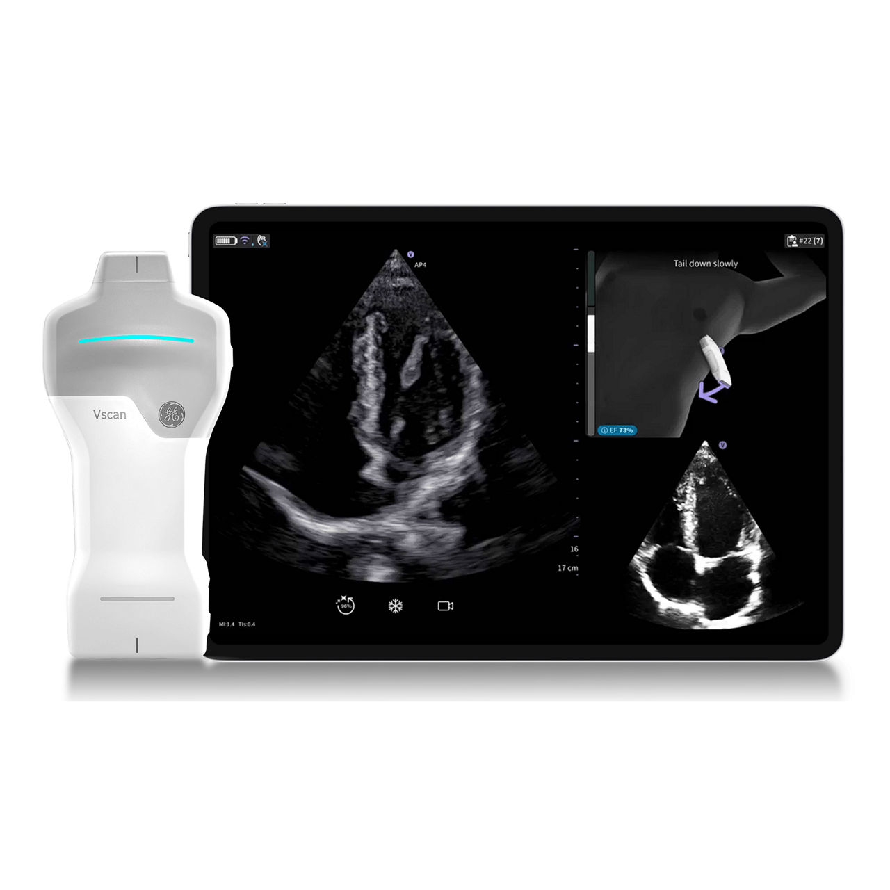 Vscan Air™ SL