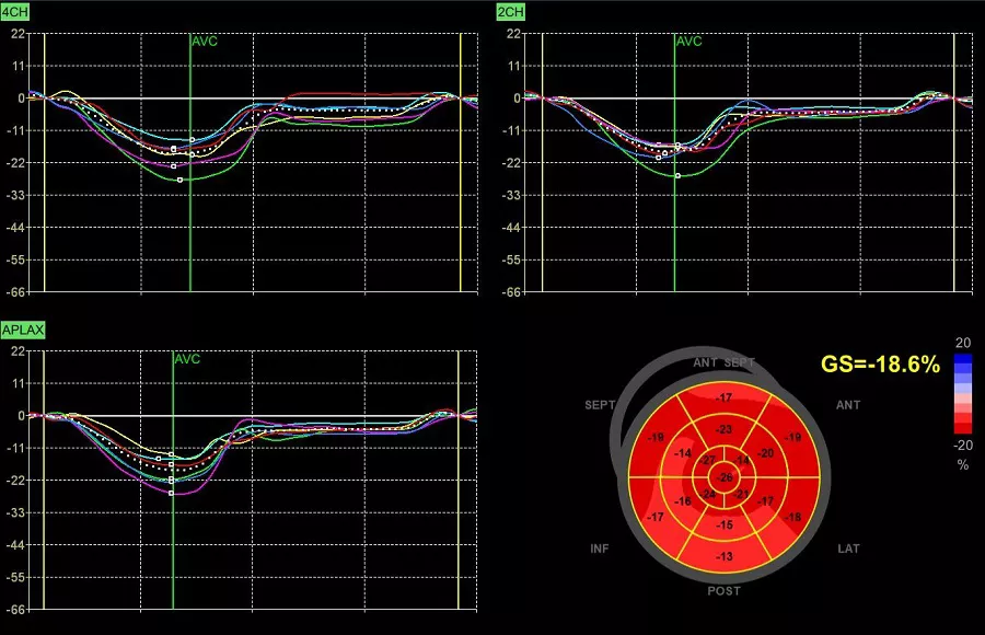 Automated Function Imaging (AFI) 2.0*