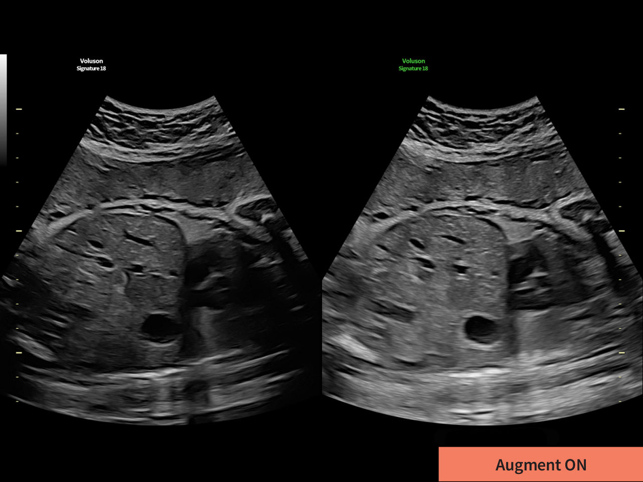 2-augment-clinical-image