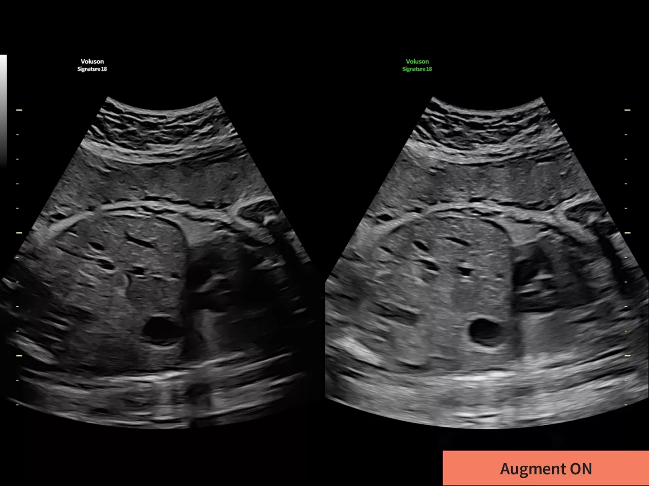 2-augment-clinical-image-ci-en