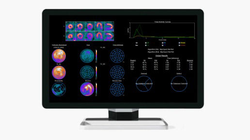 2-myospect-fh-desktop