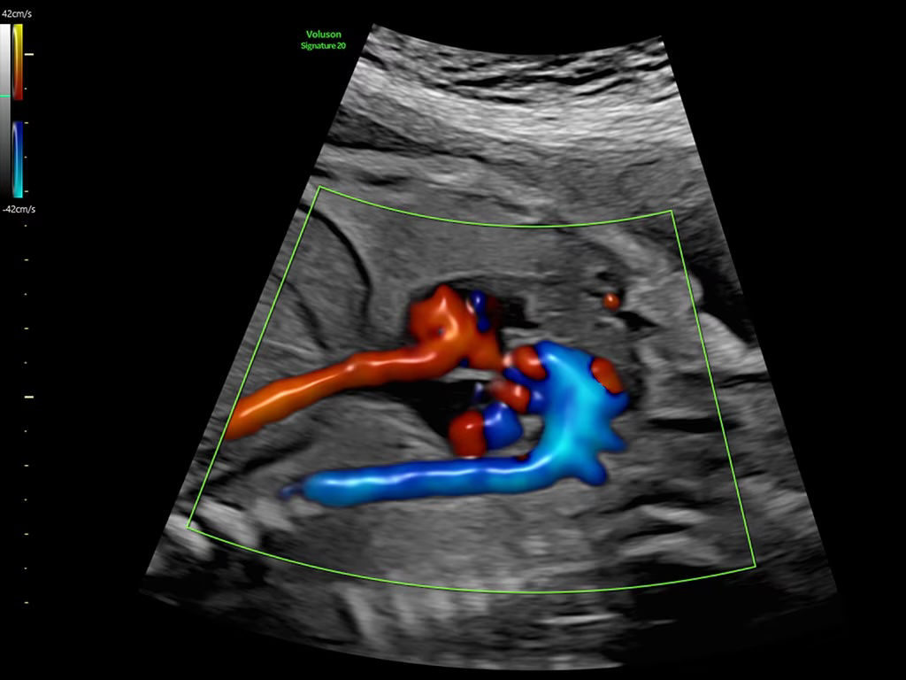 2-radiantflow-image-ci-en