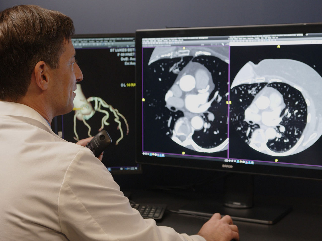 2-s-curve-centricity-ris-i-desktop