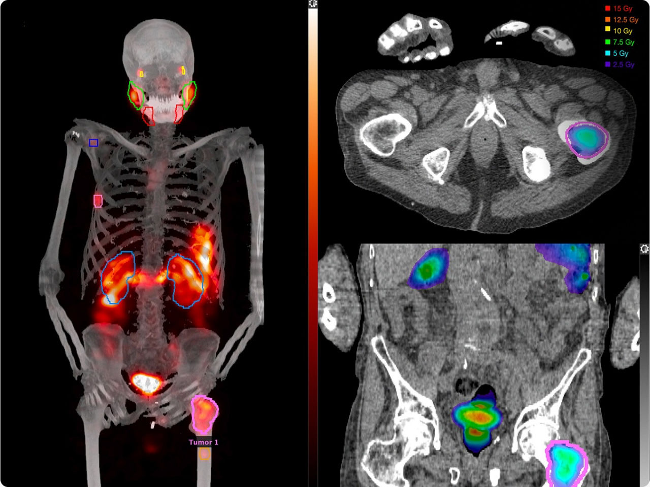 2-s-curve-mim-desktop-ci-en