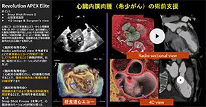 2025Cardiovascular_03_01