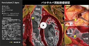 2025Cardiovascular_04_01