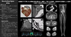 2025Cardiovascular_05_01