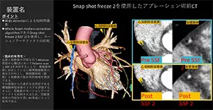 2025Cardiovascular_06_01